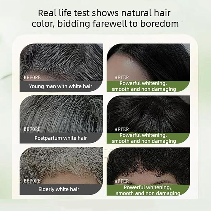 Long-Lasting Botanical Essential Oil Hair Dye,Mild Formula Long Lasting Hair Dye Set,Plant-Based Hair Color for Gray Coverage (Dark Brown)