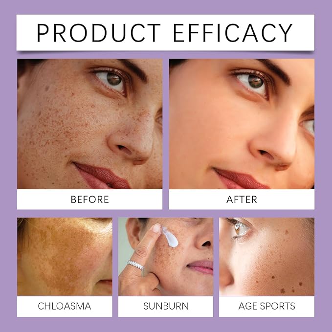 Retinol, Niacinamide & Ceramide Complex Dark Spot Corrector - Reduce Appearance of Hyperpigmentation & Fine Lines, Pore Minimizer, Anti-Aging Face Moisturizer for Sensitive & Acne-Prone Skin, 1 Oz