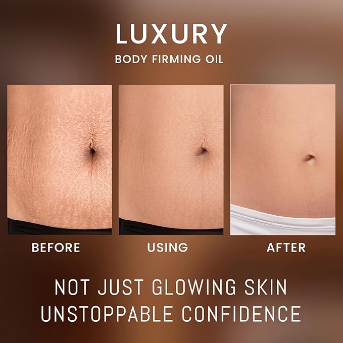 Body Firming Oil - Luxury Toning & Tightening Treatment for Crepey Skin - Hydrating, Nourishing Elixir to Improve Skin Texture & Elasticity - 120ml (1)