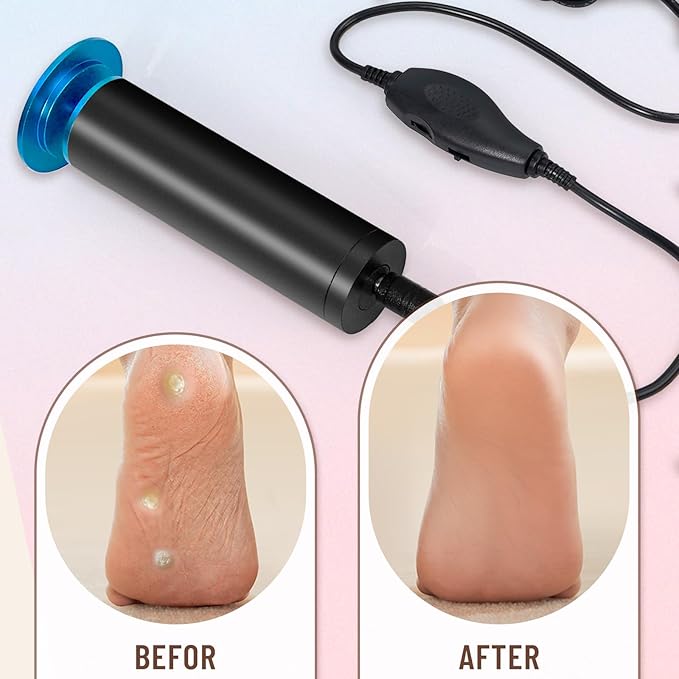 Dermawave Electric Foot File Callus Remover for Feet, Professional Foot Scrubber Sander Grinder for Dead Skin Cracked Heel, Pedicure Tool with 60 Sandpaper Discs for Men & Women