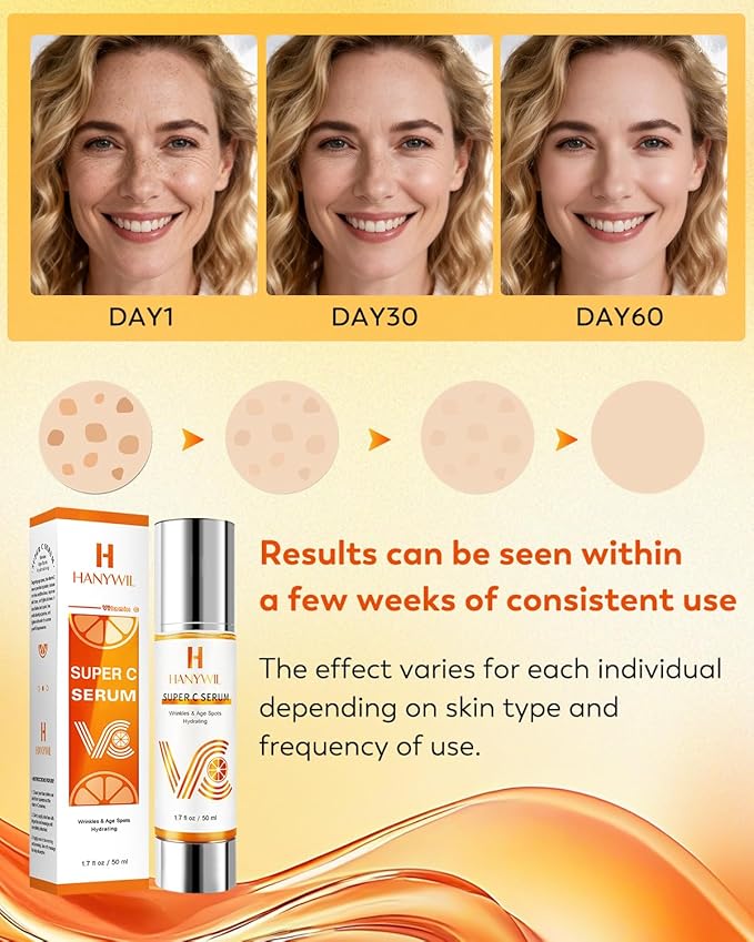 HANYWIL 20% Super Vitamin C Serum for Mature Skin 30-70 Women, Dark Spot Remover with Hyaluronic Acid & Active Lock Tech, Hydrating Total Package Serum for Wrinkles & Firming, Even Skin Tone, 1.7fl oz
