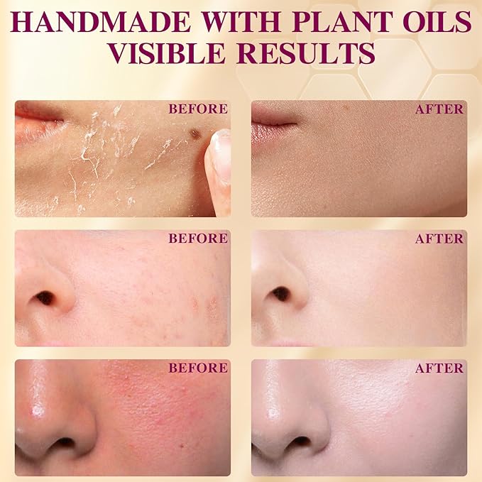 Organic Beef Tallow Honey Balm, Handmade Moisturizer Beef Tallow for Face and Body, Grass Fed Beef Tallow for Dry Skin, Pure Natural Cream with Lavender Scented, 2.1oz