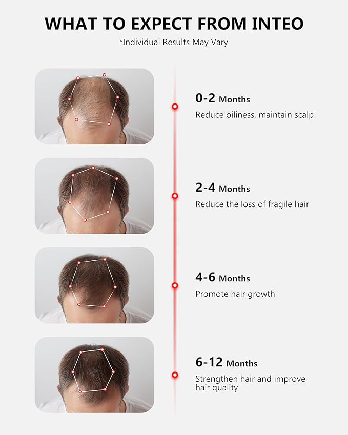 Red Light Therapy for Hair Growth, Laser Hair Growth Cap for Hair Loss, Rechargeable Battery- FDA Cleared Hair Growth for Men & Women, Wireless Red Light Hair Therapy, 162 Lasers