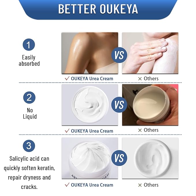 OUKEYA Urea Cream 42% plus Salicylic Acid 2% Net 5.29 Oz for Dry Cracked Feet,Heels,Knees,Elbows,Hands Repair Treatment Moisturizes and Removes Corns,Calluses,Dead Skin,and Softens Toenails Pack of 4