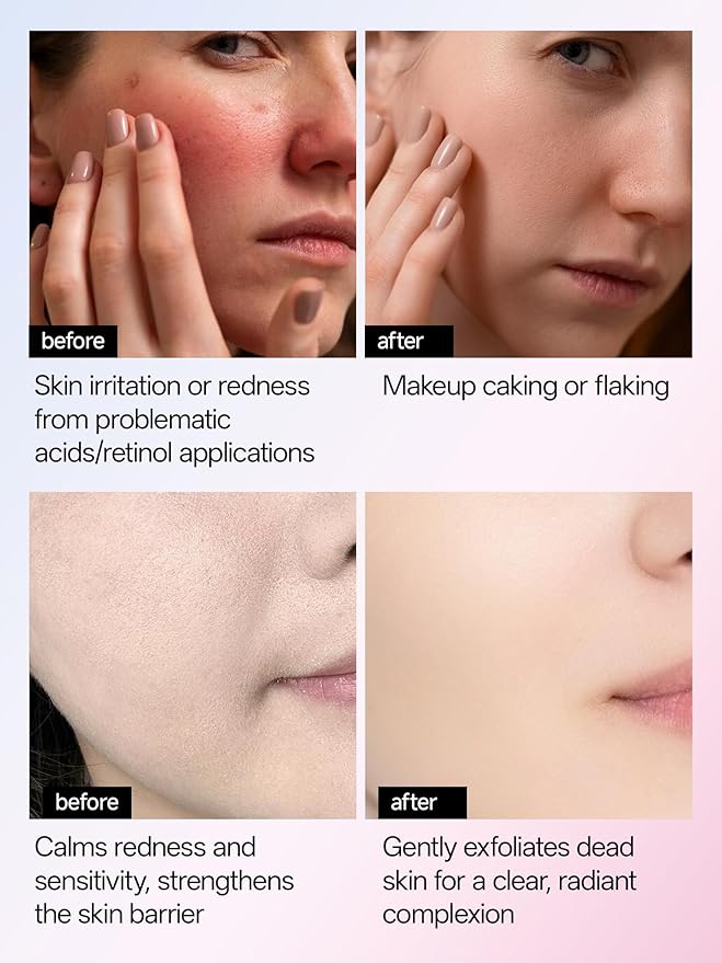 WNP 6D Bionic Collagen Bio‑Gel Mask Overnight Deep Hydration with 5.1% Collagen, Niacinamide, Hyaluronic Acid, Firming, Anti‑Aging, Brightening for Sensitive Skin 28g x 4