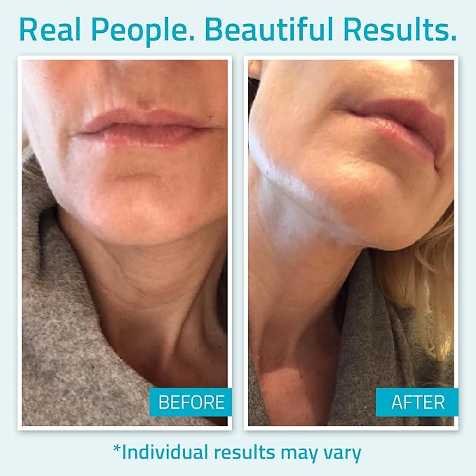 YEOUTH Day Night Face Moisturizer with Hyaluronic Acid, Snail Mucin Cream and Copper Tripeptide, Hydrating Fragrance Free Facial Moisturizer, Face Skin Care Cream for Women and Men 4oz