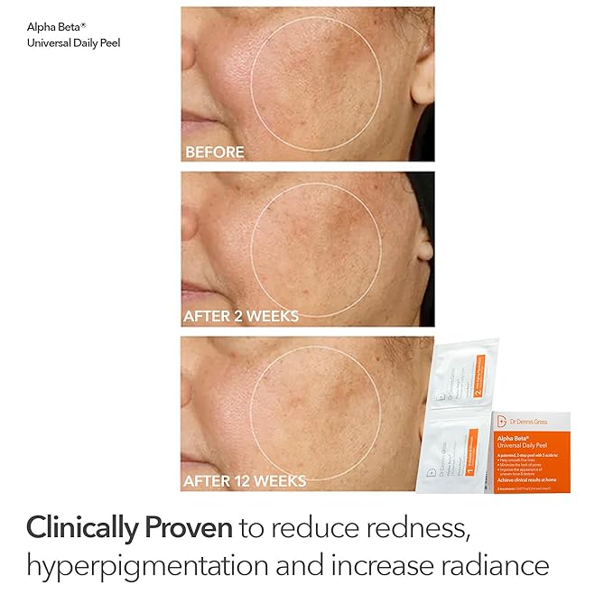 Dr Dennis Gross Boost Collagen, Brighten & Firm Kit – Pink dpl Faceware Pro LED Device + Cleansing Oil + Dewy Deep Cream + 5 Universal Daily Peels | $592 Value Limited Edition Gift Set