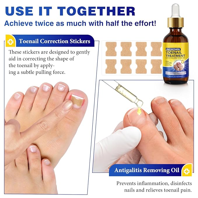 Nail Removal Kit,Toenail Drops,Softens Nails,Nail Care Tool Set,Ingrown Toenail Corrector,Corrector Patch,Nail File,60ml