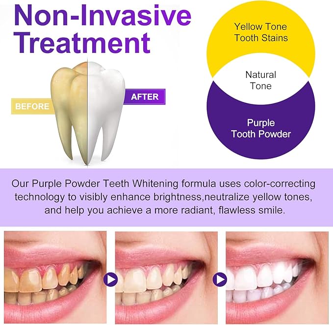 Teeth Whitening Powder - Teeth Whitening - Removes Stains - No Sensitivity - Enamel-Safe Toothpaste Power