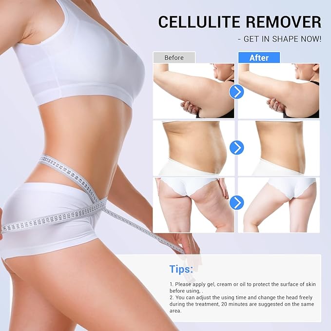 sens for Improvement in The Appearance of Cellulite Device Cellulite Massager Radio Frequency, White