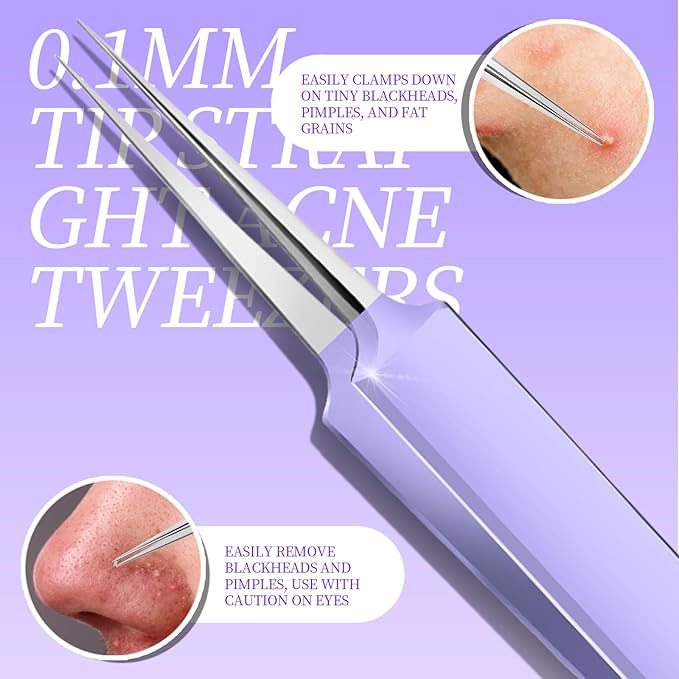 Teenitor Pimple Popper Tool Kit and Blackhead Remover Tools, Ingrown Hair Tweezers, Professional Blackhead Extractor Pimple Extractor Comedone Extractor, Black Head Remover for Face