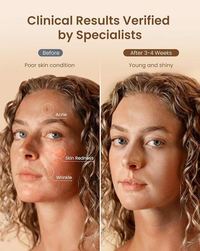 RENPHO Red Light Therapy Mask for Face 2026, Anniversary Christmas Gifts for Women Mom Wife, 324 LEDs Full Face Coverage & 3 Light Modes, Cordless LED Red Light Therapy Face Mask for Home Use & Travel