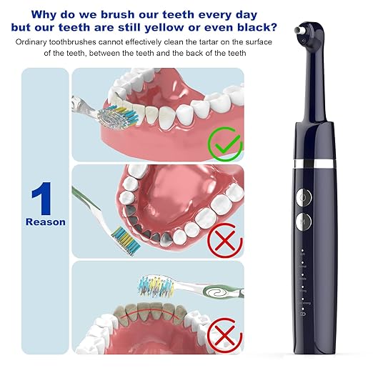 Tooth Polisher,Teeth Polishing Kit for Daily Cleaning,Polishing Then Whitening of Tooth (Professional Toothpaste Include),USB Rechargeable Dental Polisher with LED Light,6 Heads,5 Speed Modes