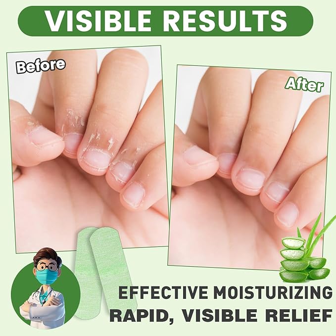 50PCS Aloe Vera Cracked Hands Treatment Patches, Dry Cracked Hands Repair Bandage