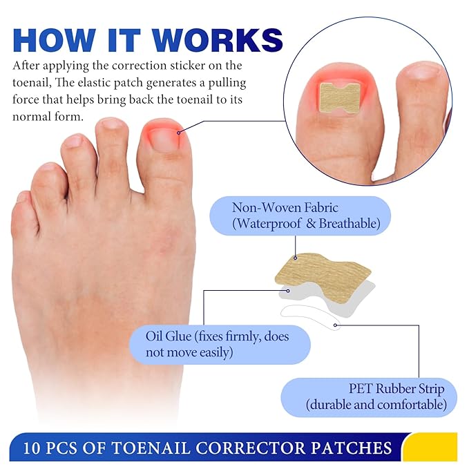 Nail Removal Kit,Toenail Drops,Softens Nails,Nail Care Tool Set,Ingrown Toenail Corrector,Corrector Patch,Nail File,60ml