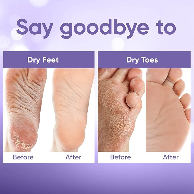 Foot Peel Mask - Foot Mask for Baby Soft Skin - Remove Dead Skin, Dry, Cracked Feet & Callus, Foot Spa, Made with Aloe Vera Extract for Women and Men (5 Pairs Lavender)