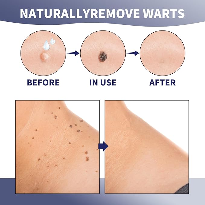 Natural Care Cream, Smoothes Skin, with Niacinamide & Licorice Root Extract, Lightweight, Fast-Absorbing, Daily Skincare Solution, 20g (2 Pcs)