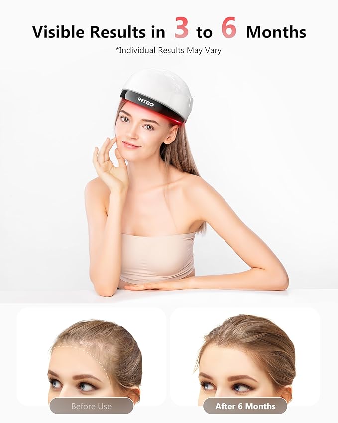 Red Light Therapy for Hair Growth, Laser Hair Growth Cap for Hair Loss, Rechargeable Battery- FDA Cleared Hair Growth for Men & Women, Wireless Red Light Hair Therapy, 162 Lasers