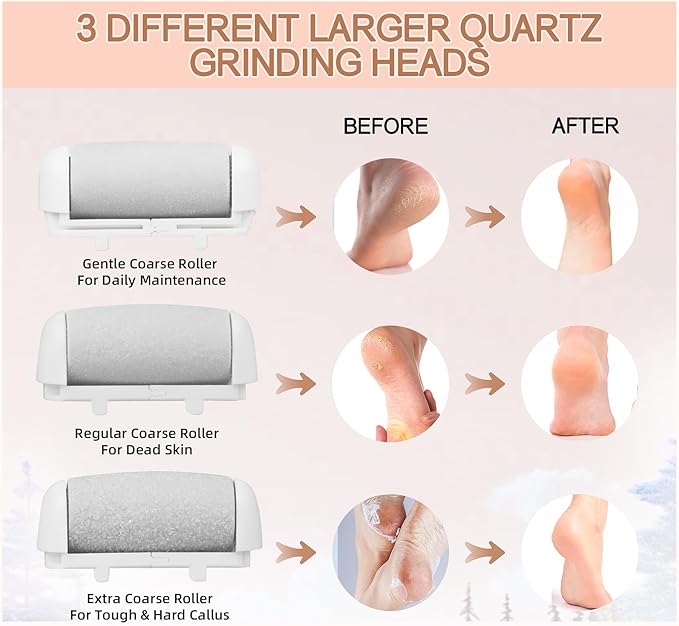 AdamPark Callus Removers 8 Pack Replacement Rollers Heads for Electric Feet File Pedicure Tools, Pedicure Kit Refill Rollers 3 Extra Coarse, 3 Regular Coarse, 2 Fine Coarse Refill Rollers