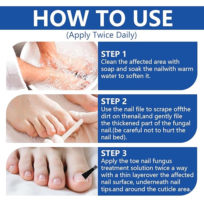 Toenail Fungus Treatment Extra Strength, Nail Fungus Treatment with 25% Undecylenic Acid, Upgraded Fungal Nail Repair for Yellow, Discolored, Thick and Ingrown Nails, 2 Bottles