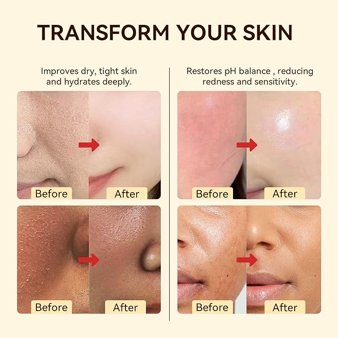 Beef Tallow for Skin - Natural Honey and Tallow Balm Nourishing Tallow Face Moisturizer Cream, Formula with Grass-Fed Organic Whipped Tallow for Dry, Cracked Face & Body Skin Care Daily Use (2 oz)