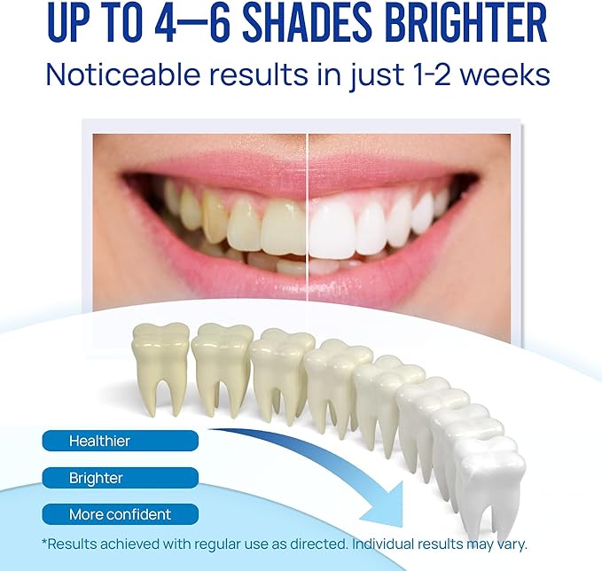 Teeth Whitening Pen Gel Kit: 35% Carbamide Peroxide Gel for Stain Removal - No Sensitivity with Remineralizing Pen for a Brighter Whiter Smile Mint (5 Pack)