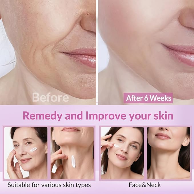 Neck Firming Creams for Tightening and Firming, Moisturizer Face Cream with Collagen, Hyaluronic Acid, Day & Night Anti-Aging Skin Tightening Cream for Neck, Décolleté & Face – 1.7Fl Oz