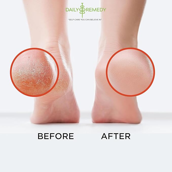 Muscle Relief Foot Soak with Epsom Salt, Made in USA, Soothe Tired Feet, Softens Calluses and Helps Athletes Foot 1lbs