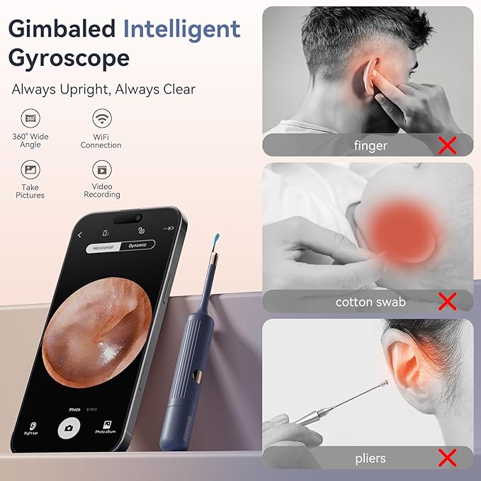 Ear Wax Removal Kit: Smart Visual Ear Cleaner with Camera 1080P HD for Adults & Kids - Flexible Ear Wax Remover with 6 LED Lights - Safe Ear Cleaning Tool for Home Use