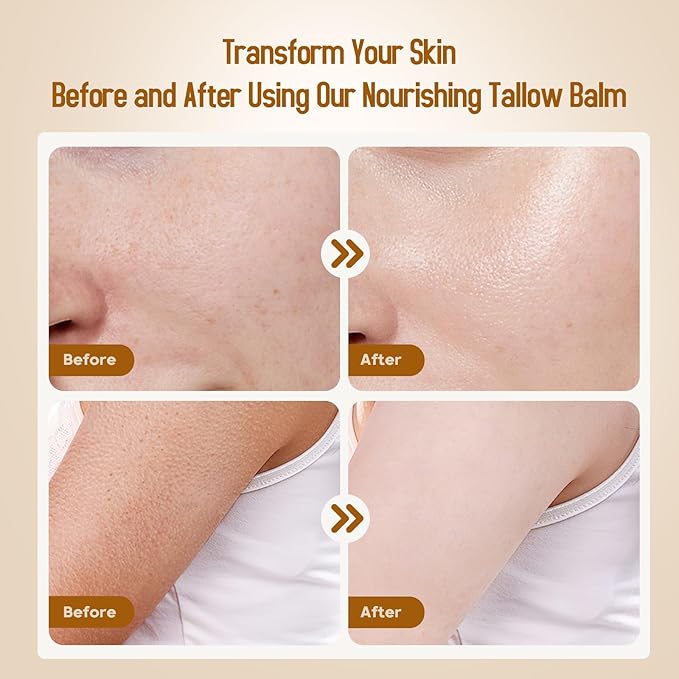 Beef Tallow for Skin, Beef Tallow and Honey Balm, 100% Organic Grass-Fed Beef Tallow Balm, Face & Body Moisturizer, Deeply Nourishment for Dry, Cracked, Sensitive Skin, Natural Formula (4 Oz)