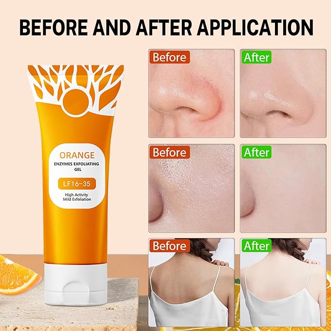 2Pcs Orange Exfoliating Gel For Face & Body,2026 Exfoliating Cleansing Gel Scrub,Pore Orange Peeling Scrub,Deep Clean Pores,Remove Blackheads & Moisturize Skin,All Types Skin