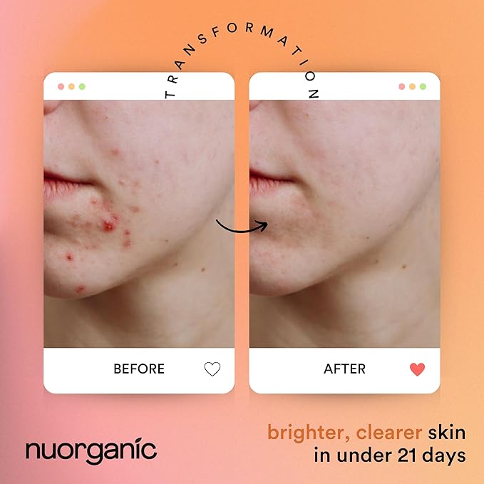 nuorganic Turmeric Face Mask - Soothing, Acne Clearing, Pore Refining, Exfoliating - New Airtight Squeezy Tube, Stays Fresh for 12 Months - Clean & Natural