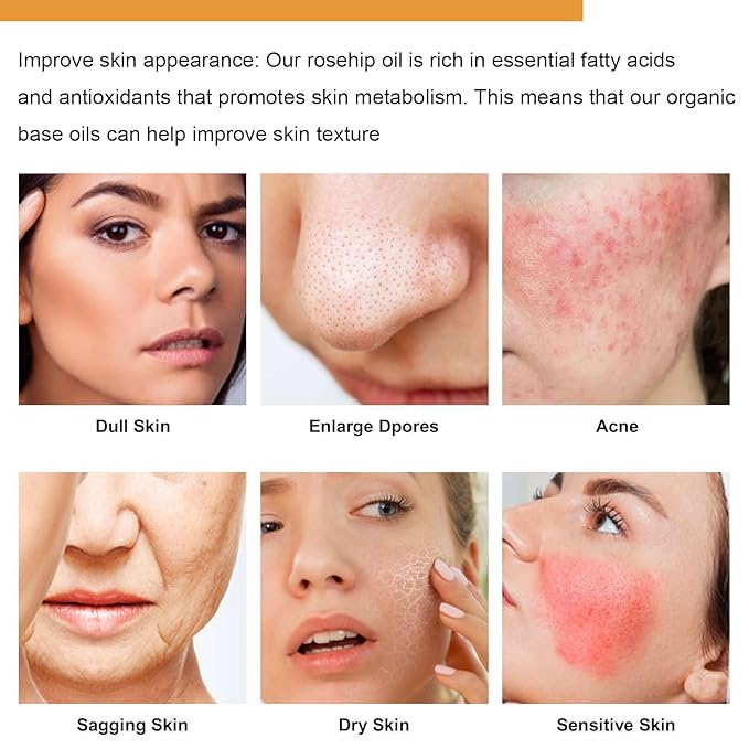 Rosehip Seed Oil for Face, 100% Organic Cold Pressed Rosehip Oil, Rose Hip Seed Oil Moisturizer Skin Face, Hair, Nails and Body, Anti-Aging, Smooth Fine Line & Wrinkle, 30ml