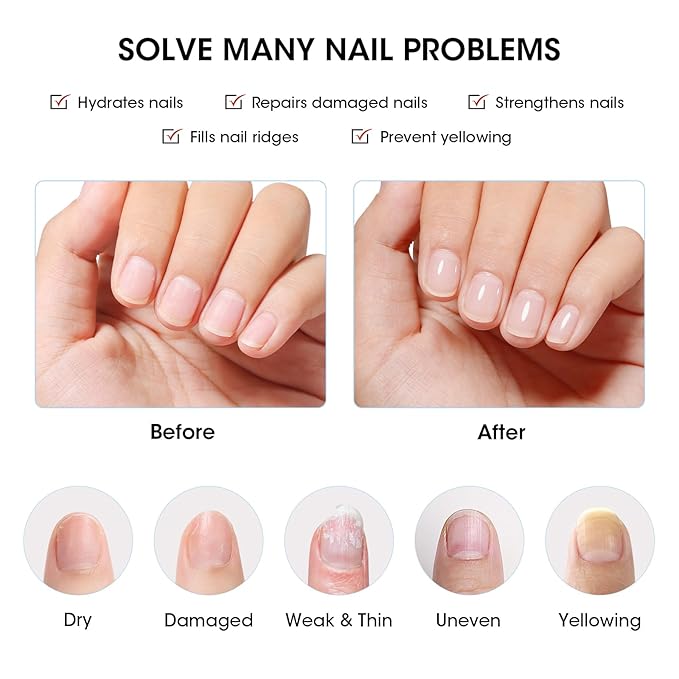 GELLEN Tinted Milky White Ridge Filler For Nails, Clear Nail Polish Ridge Filling Base Coat, Nail Strengthener and Growth, Hydrate Strengthen Nourish Damaged Dry Nails, Shea Butter & Vit E & Protein