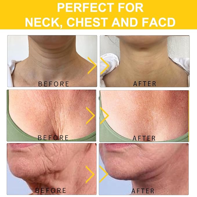 Neck Cream, Neck Creams for Tightening and Firming, Wrinkle Cream for Women, Skin Tightening Cream for Face, Neck, Chest & Décolleté.