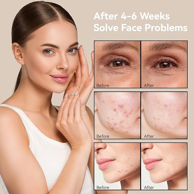 MEGELIN 7 Colors Led Light Therapy Facial Mask, Face Light Therapy Mask for Face, Reduce Wrinkles Smooth Skin, Infrared Light Skin Rejuvenation