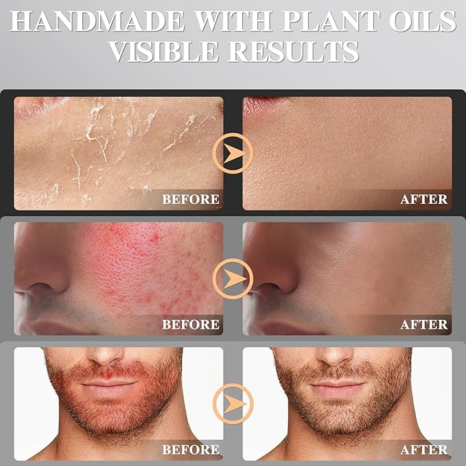 Organic Beef Tallow Honey Balm, Handmade Moisturizer Beef Tallow for Face, Grass Fed Beef Tallow for Dry Skin, Pure Natural Cream with Bergamot Scent,Designed for Men After Shave, 2.1oz