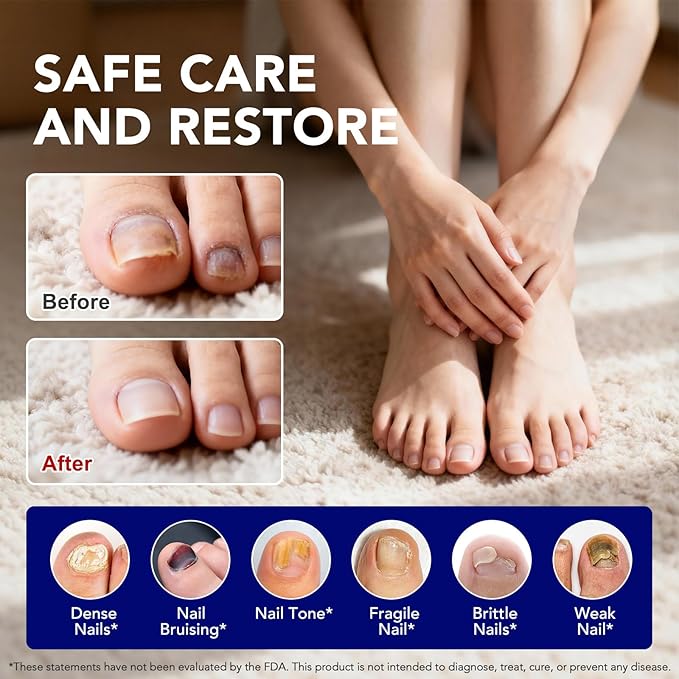 Toenail Fungus Pen | Toenail Fungus Treatment Extra Strength | 25% Undecylenic Acid, Tea Tree Oil | Toe nail Fungus Treatments for Fingernails & Toenails | 4PCS Fungal Nail Care Pen for Damaged Nails