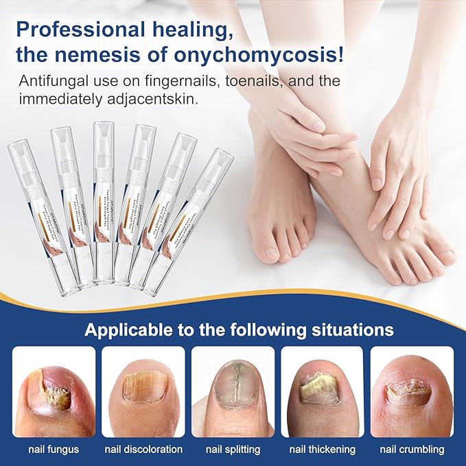 Toenail Fungi Treatment Extra Strength - Fungi Nail Pen, Ingrown toenail treatment, nail repair, Fungus nail treatment, yellow toenail, Damaged Nails foot fungus treatment extra strength