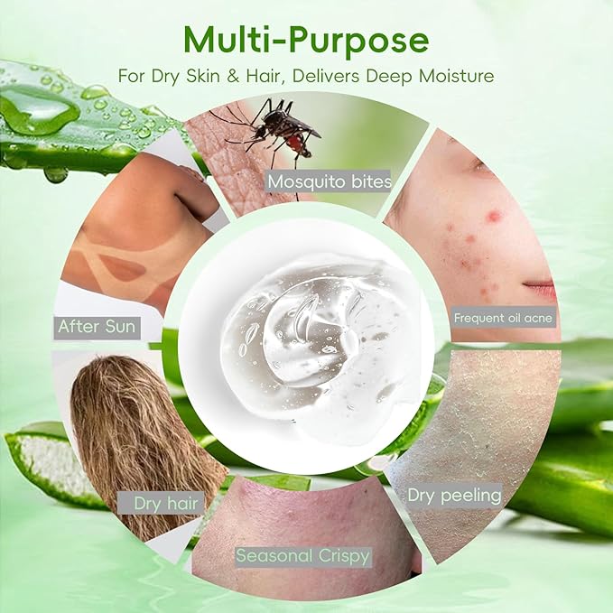 Organic Pure Aloe Vera Gel - Soothing Cooling Gel for Sunburn Relief & sun burnt after-sun gel for skin Face hair | pure 99% Plant-Derived, | 7.05oz, Gentle for All Skin Types