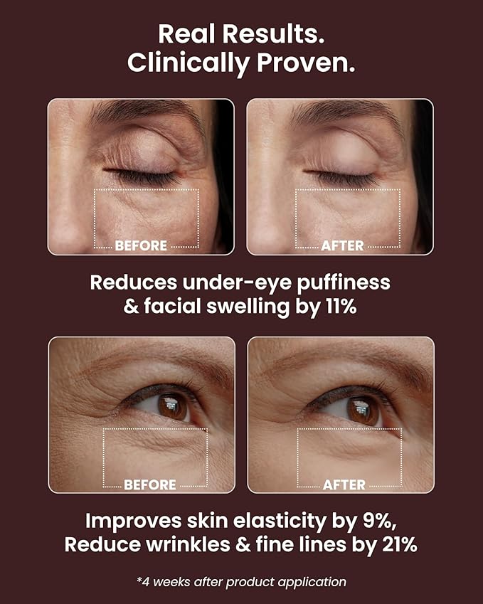 Ice Roll Serum for Face, Puffy Eyes, Under Eye Bags - Bakuchiol & Collagen for Wrinkles, Anti Aging, Ice Roller for Puffiness, Redness, Dark Circles - Korean Skin Care & Gua Sha, 1.69 Fl Oz