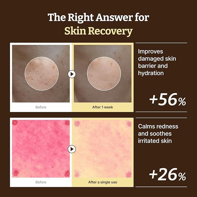 Dr. Reju-All Advanced PDRN Rejuvenating Cream – 99% Pure Salmon DNA PDRN Face Moisturizer – Optimal 1200ppm Concentration for Glow Skin – Korean Anti-Aging Skin Care Face Cream - 2.0 Fl Oz