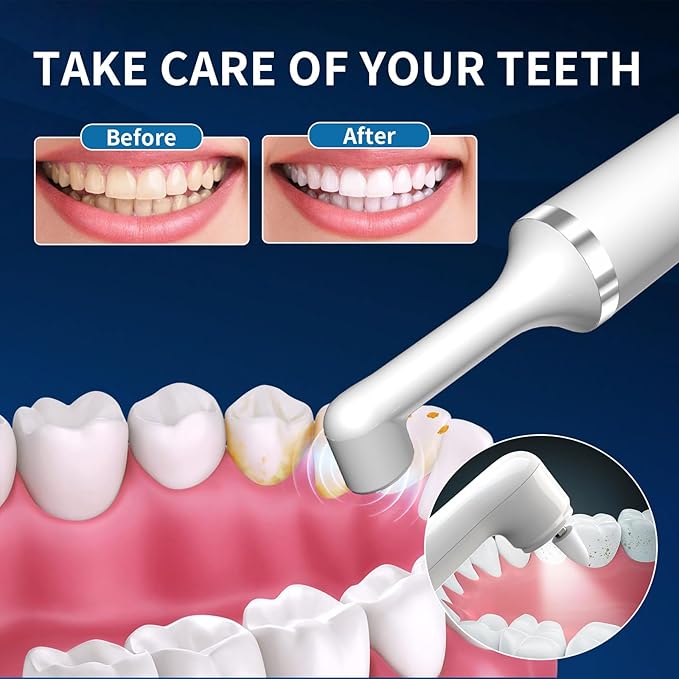 Plaque or Electric Tartar Polishing TeethKit with LED Light 5 Speed Modes with 5 Replacement Brush Heads (White)