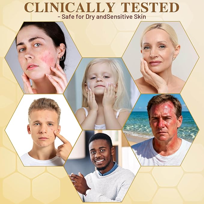 Organic Beef Tallow Honey Balm, Handmade Moisturizer Beef Tallow for Face and Body, Grass Fed Beef Tallow for Dry Skin, Pure Natural Cream with White Tea Scent, 2.1oz