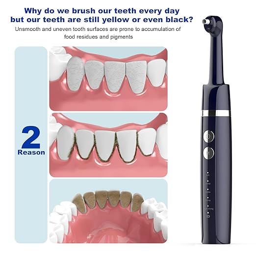 Tooth Polisher,Teeth Polishing Kit for Daily Cleaning,Polishing Then Whitening of Tooth (Professional Toothpaste Include),USB Rechargeable Dental Polisher with LED Light,6 Heads,5 Speed Modes