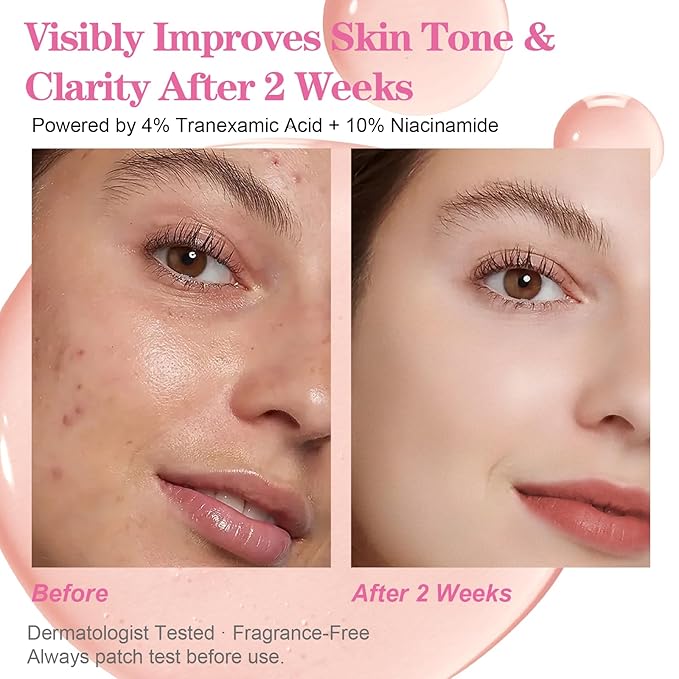 TXA 4% + Niacinamide 10% + Arbutin 2%, Hyaluronic Acid, Hydrating and Clarifying Facial Serum for Smooth, Radiant Looking Skin, Uneven Tone Care (30ml /1.01 fl.oz)