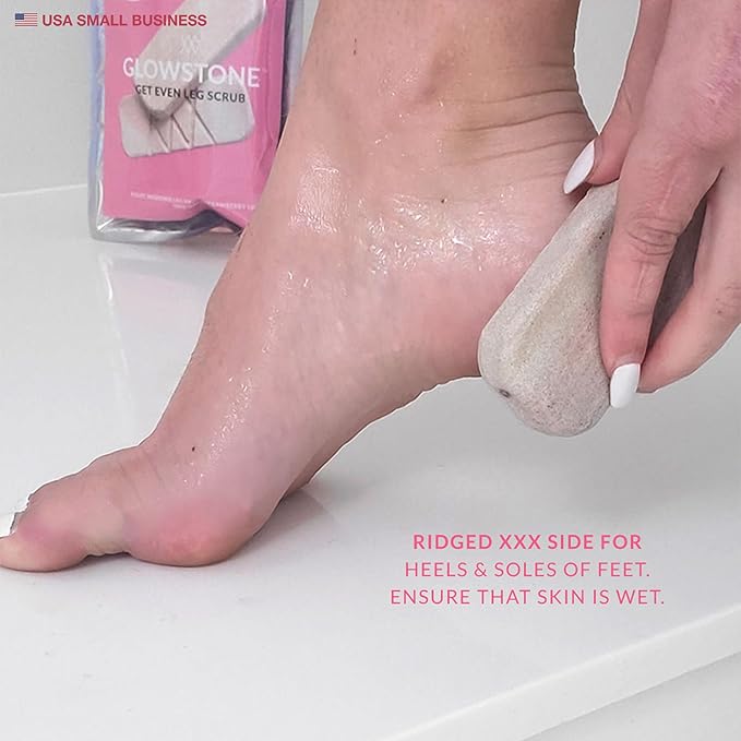 GET EVEN LEG SCRUB: 2-Sided Strawberry Legs Treatment, Ingrown Hair Exfoliator, Dead Skin Scrubber & Exfoliating Body & Foot Scrub For Dry Skin and KP | Glowstone