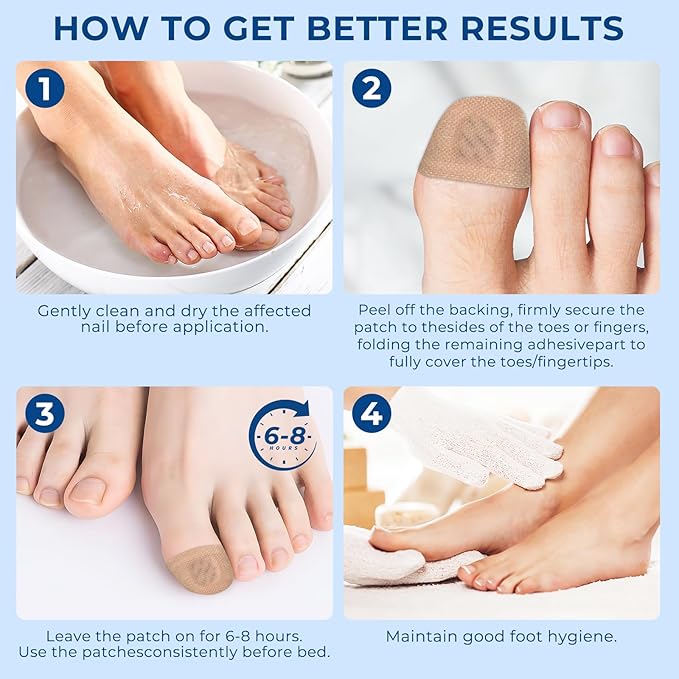 Toenail Fungus Treatment Extra Strength - 32 Pcs Fungal Nail Patches, 8-Hour Nighttime Renewal Toenail Fungus Patches for Damaged Nails and Appearance of Discolored