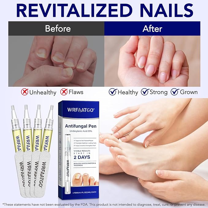 Toenail Fungus Pen | Toenail Fungus Treatment Extra Strength | 25% Undecylenic Acid, Tea Tree Oil | Toe nail Fungus Treatments for Fingernails & Toenails | 4PCS Fungal Nail Care Pen for Damaged Nails