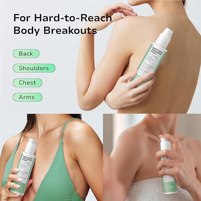 Back & Body Acne Spray Treatment: 2% Salicylic Acid & Tea Tree Oil Bacne Spray for Clear, Soothe & Moisturize - Effective for Men, Women, Teens with Back, Chest, Shoulder, Arm Acne